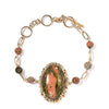 Unakite